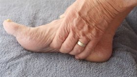 Судороги ног у пожилых: причины и лечение