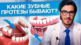 Какие зубные протезы бывают? Какие бывают зубные протезы: виды и особенности?
