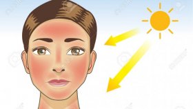 Как проявляется солнечный дерматит и что с ним можно сделать?