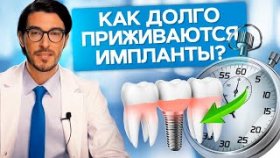 Как долго приживаются импланты? Как долго приживаются зубные импланты? Причины отторжения имплантов.