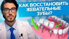 Как восстановить жевательные зубы? Сколько необходимо имплантов, чтобы восстановить жевательные зубы