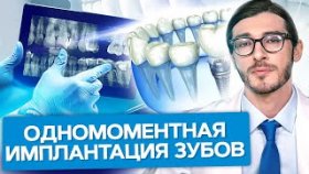 Одномоментная имплантация зубов. Можно ли установить зубные импланты за один визит?