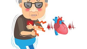 Можно ли умереть от сердечного приступа?