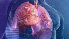 Динамика смертности от рака дыхательных путей меняется