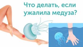 Предоставление первой помощь человеку в случаях, если ужалила медуза