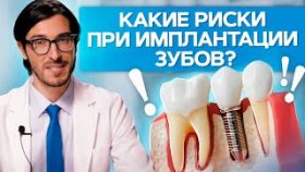 Какие риски при имплантации зубов? Какие существуют риски при имплантации зубов и как их уменьшить?