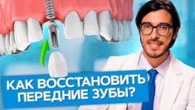 Как восстановить передние зубы? Как восстановить передние зубы с помощью имплантов и коронок?