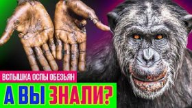 Оспа обезьян. Как распознать и чем лечить? Что известно о вспышке нового заболевания - обезьянья оспа?