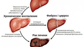 Почему раком печени страдает много людей?