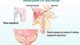 Массаж простаты — чем он полезен?