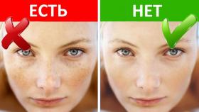 Как избавиться от веснушек на лице