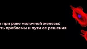 Метастазы при раке молочной железы