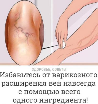 Открыть в полный размер