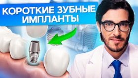 Короткие зубные импланты. Что такое короткие зубные импланты и в каких случаях устанавливаются?