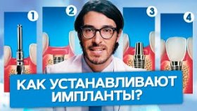 Как устанавливают импланты? Как поэтапно устанавливают импланты, какие результаты и рекомендации?