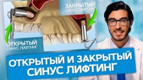 Открытый и закрытый синус лифтинг. В чем разница между открытым и закрытым синус лифтингом?