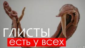 Как узнать есть ли глисты и как их вывести?
