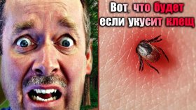 Как начинали изучать клещевой энцефалит в СССР и что будет если укусит клещ