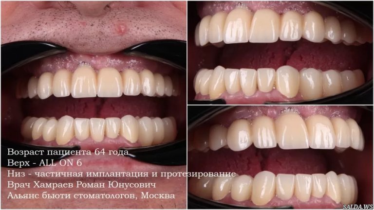 Открыть в полный размер