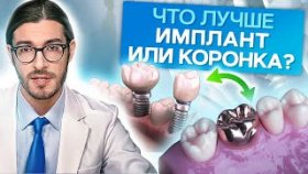 Что лучше имплант или коронка? Что лучше выбрать: имплант или коронку и каких ситуациях?