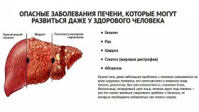 10 признаков больной печени