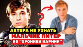 Как изменился мальчик Питер из фильма &quot;Хроники Нарнии&quot; за 15 лет? Актера не узнать