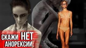 Звезды которые ДОВЕЛИ СЕБЯ до анорексии