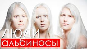 Кто такие люди альбиносы? Это важно знать!