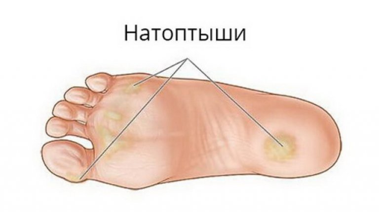 Открыть в полный размер