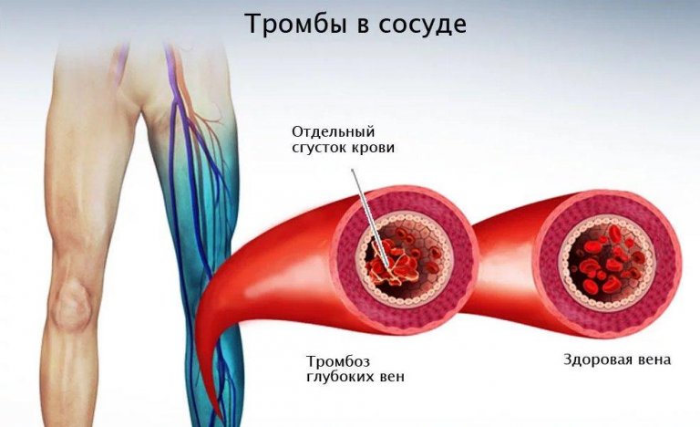 Открыть в полный размер